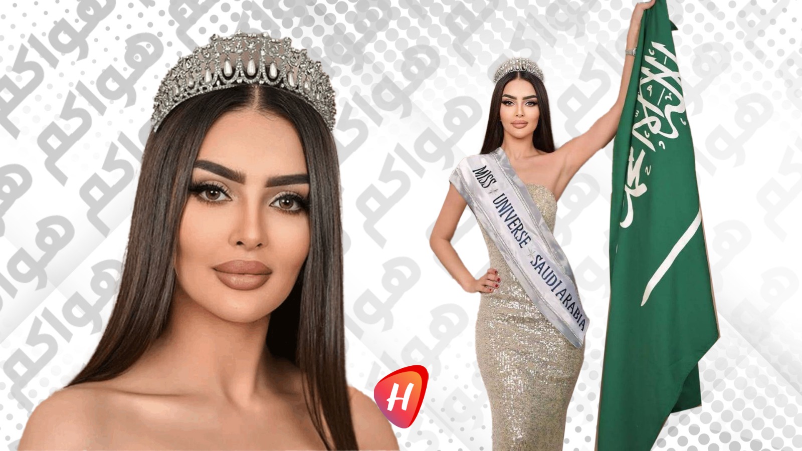 ملكة جمال السعودية رومي القحطاني تكشف عن جرح في وجهها وتروي قصة صراعها مع الألم والقوة الداخلية