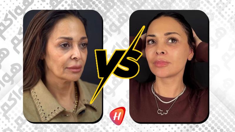 راندا البحيري تكشف صور داليا البحيري قبل وبعد شد الوجه.. النتيجة صادمة