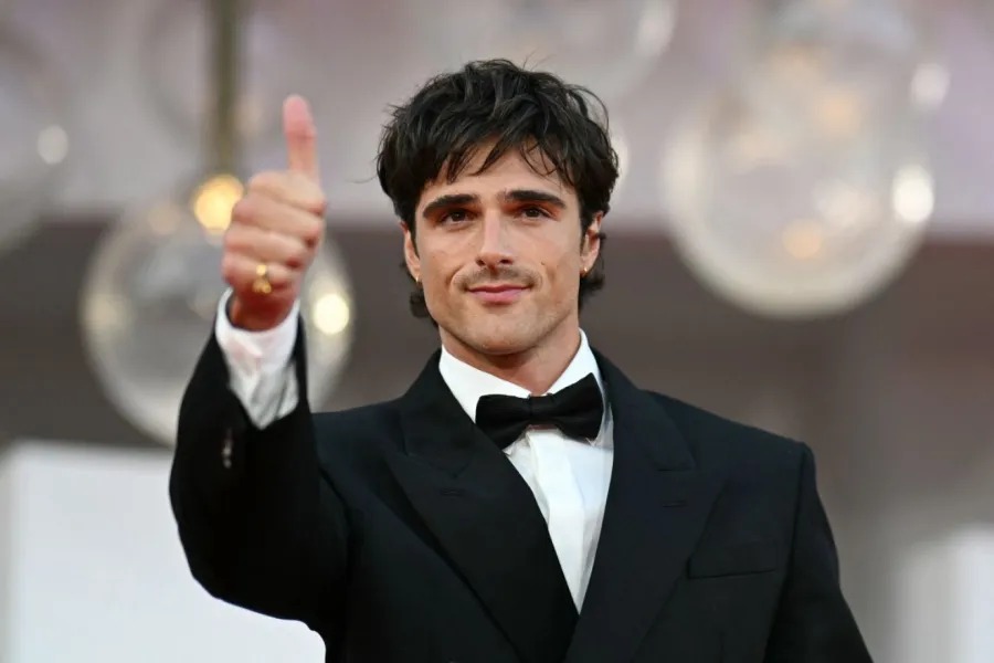 جاكوب إلوردي يتعرض لحروق بالغة وخطيرة أثناء تصوير 