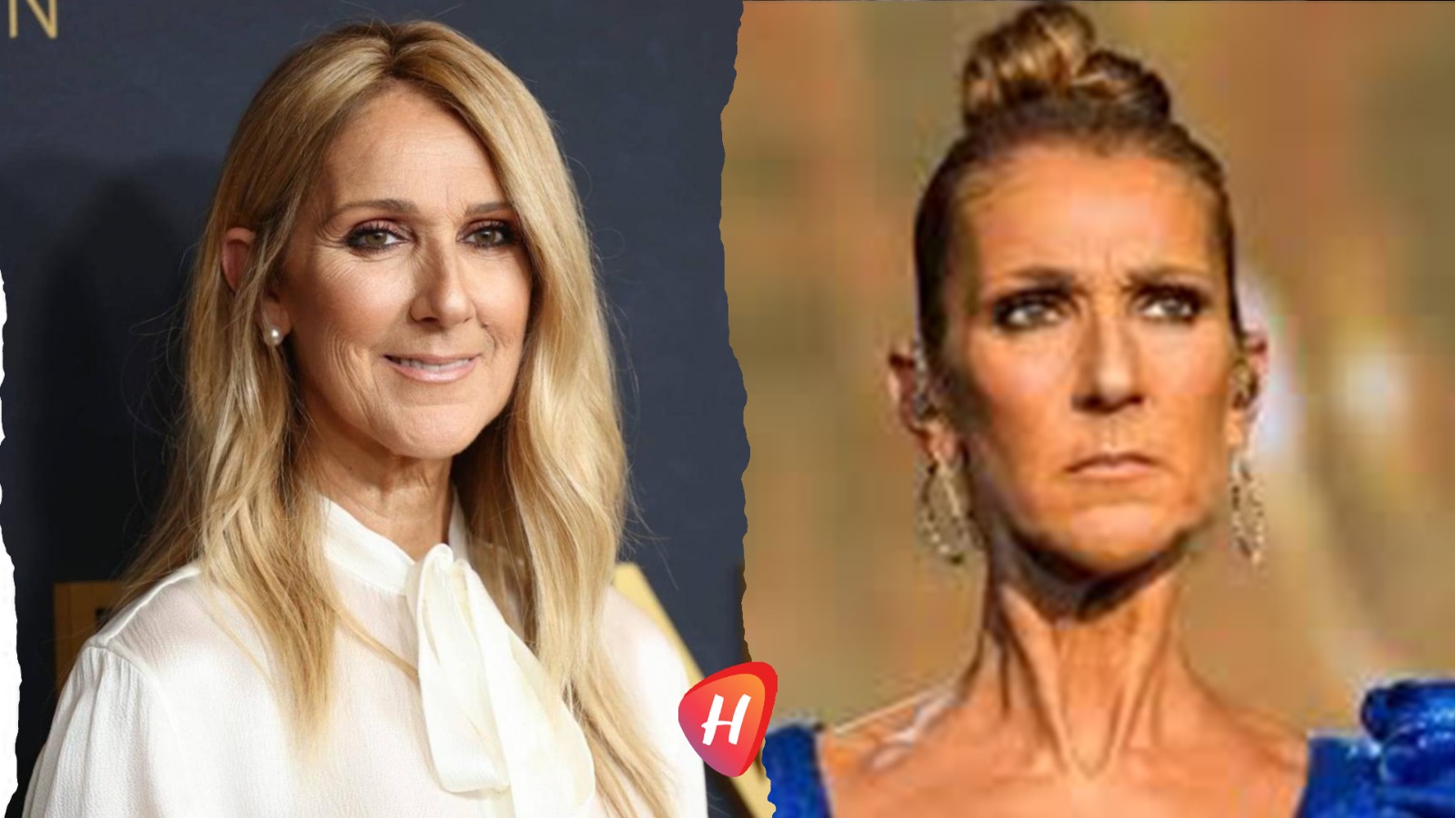 فيديو مؤلم يوثّق معاناة سيلين ديون مع مرض نادر