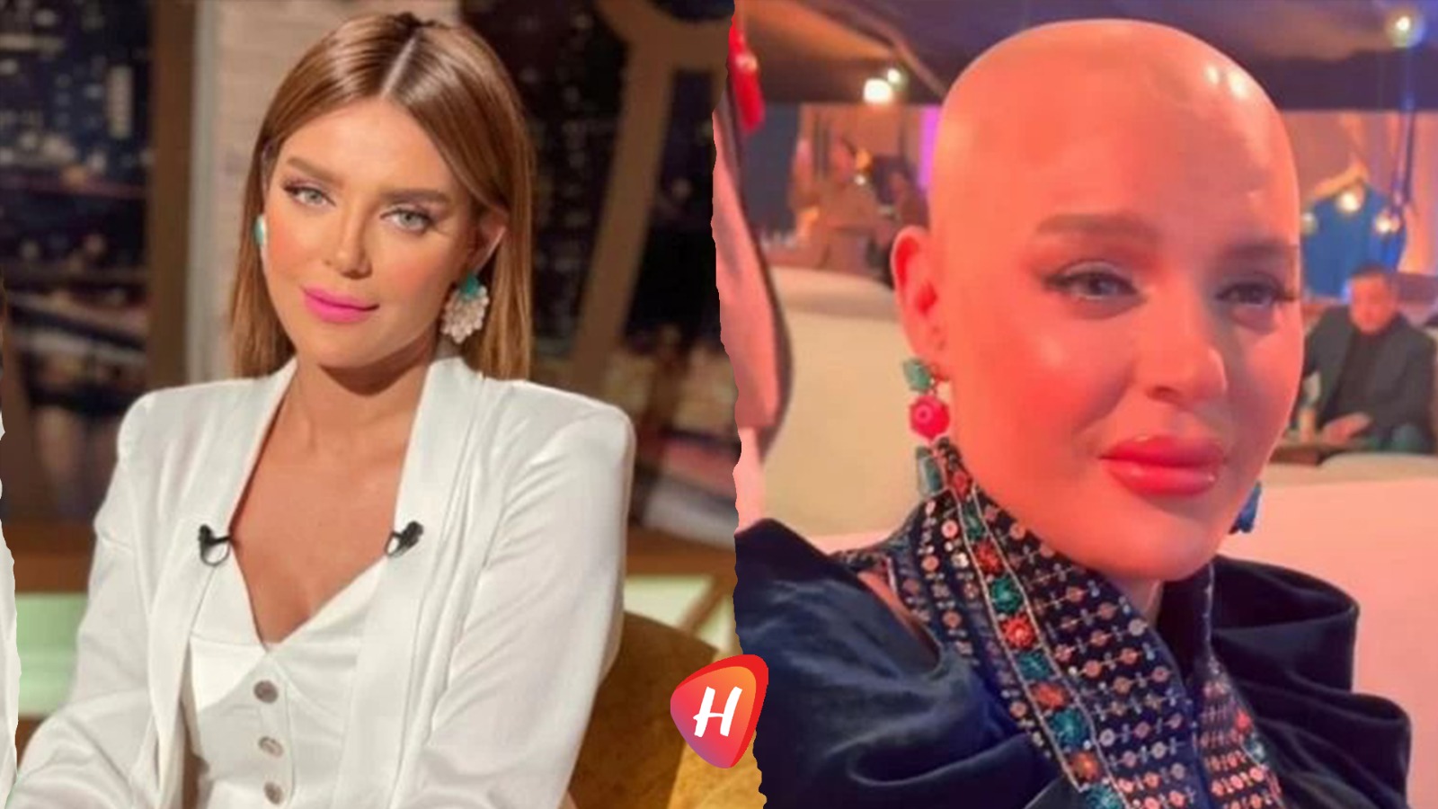 معاناة هبة السيسي مع السرطان: ندم على تجربة الكيماوي وتفاصيل رحلة الألم