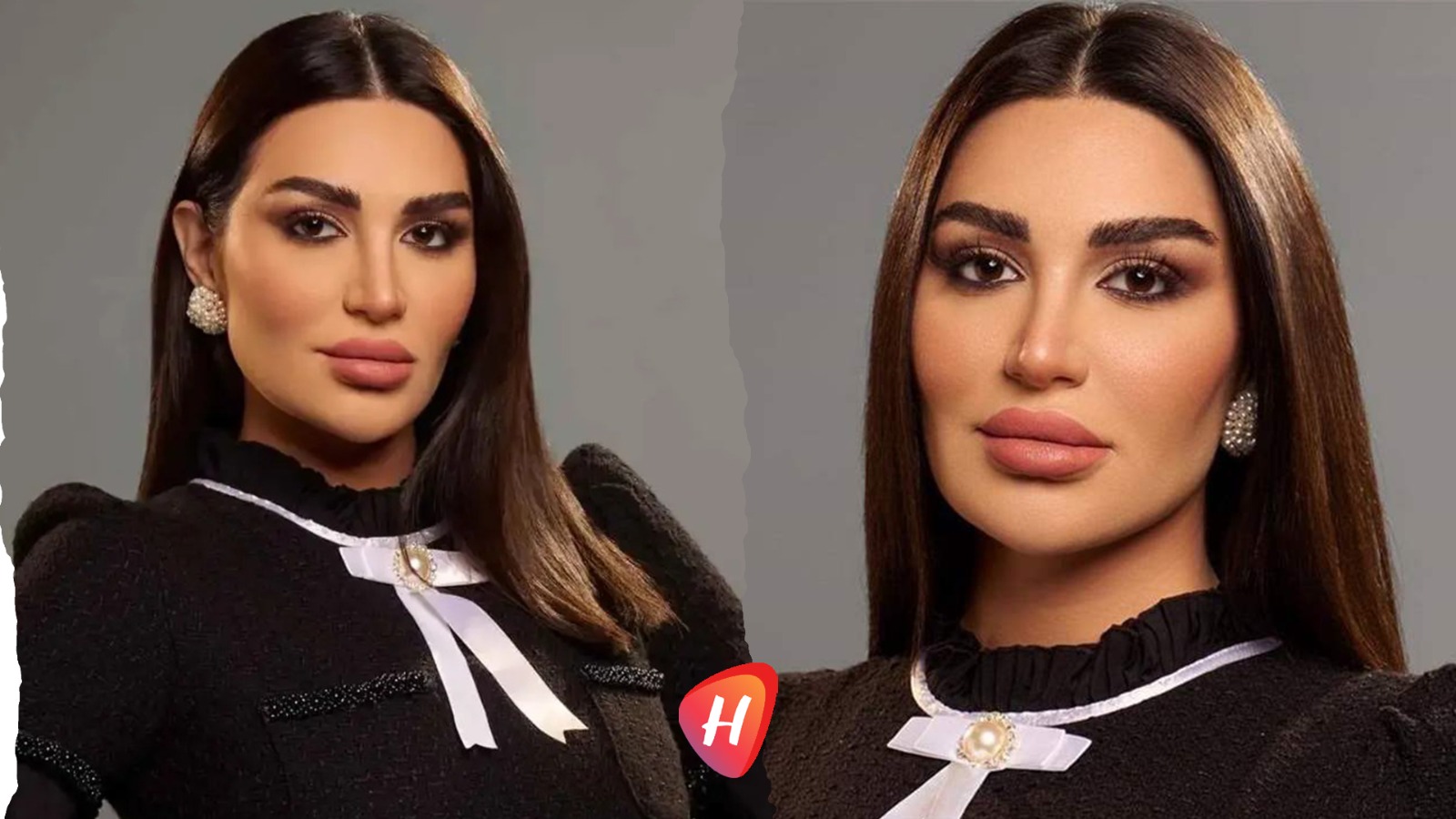 سارة نخلة تكسر صمتها.. هذا هو سبب قيامها بعملية جراحية دقيقة